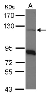 COPB1 / Beta-COP Antibody