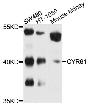 CYR61 Antibody (aa120-220)