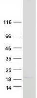 Human MAX Protein (Recombinant Myc-DDK (Flag))