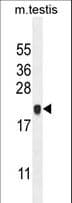 C4orf46 Antibody (aa84-113)