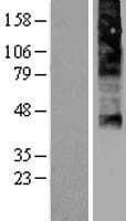 FLVCR / FLVCR1 Protein (Over-Expression Lysate Myc-DDK (Flag))