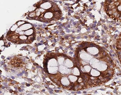 Polyclonal Rabbit anti-Human KRT20 / CK20 / Cytokeratin 20 Antibody (IHC, IF, WB)