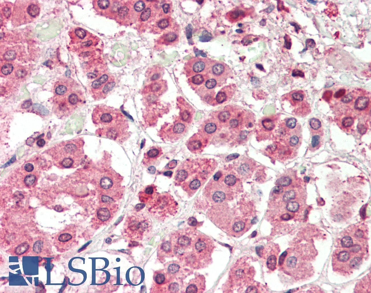 Polyclonal Rabbit anti-Human PBX2 Antibody (N-Terminus, IHC, WB)