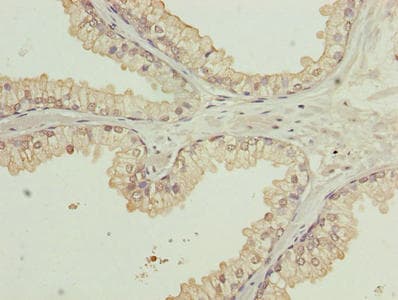 Polyclonal Rabbit anti-Human WDR91 Antibody (IHC)