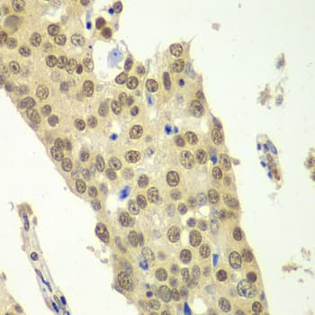 Polyclonal Rabbit anti-Human IKBKB / IKK2 / IKK Beta Antibody (IHC, IF, WB)