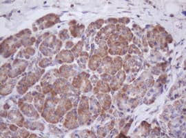 IF3mt / MTIF3 Antibody (aa56-278, clone OTI4B6)