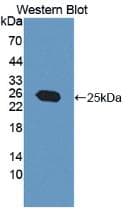 MGMT Antibody (aa1-207, APC)