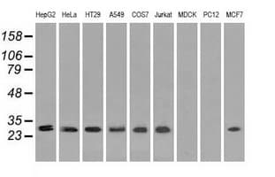 RPA2 / RFA2 / RPA34 Antibody (clone OTI9A1)