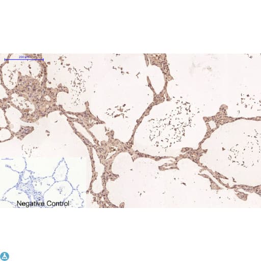 Monoclonal Mouse anti-Human TUBG1 / Tubulin Gamma 1 Antibody (IHC)