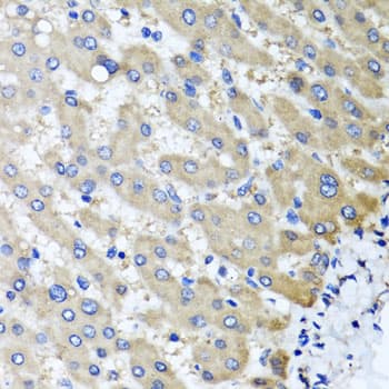 Polyclonal Rabbit anti-Human RBP2 / CRBPII Antibody (IHC, IF, WB)