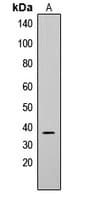Polyclonal Rabbit anti-Human CD79B / CD79 Beta Antibody (Internal, WB)
