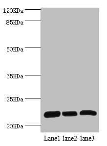 RPL9 / Ribosomal Protein L9 Antibody