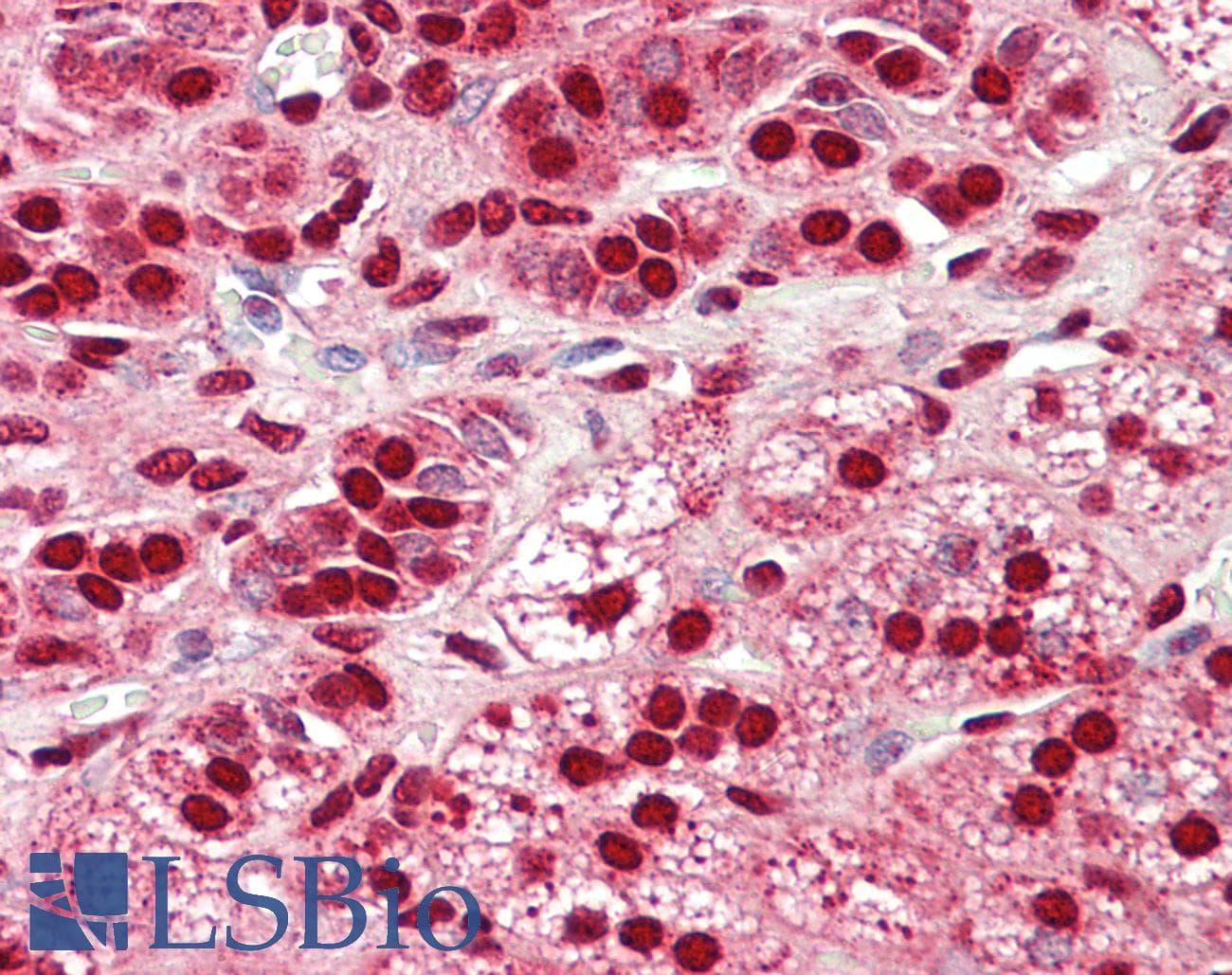 IHC-plus™ NDFIP1 / N4WBP5 Antibody