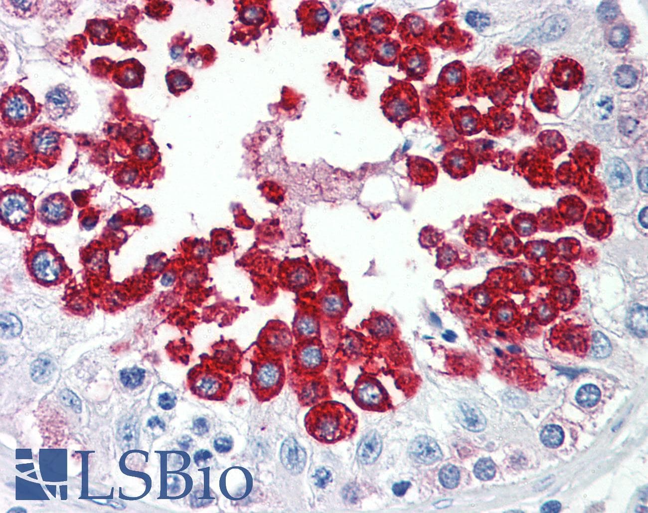 IHC-plus™ MSY2 / YBX2 Antibody (Internal)