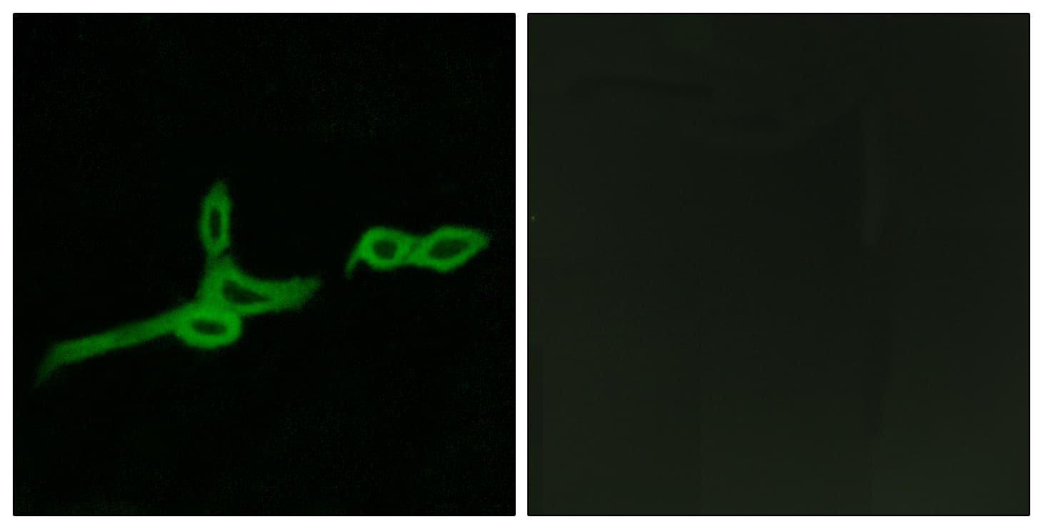 BOB / GPR15 Antibody (aa201-250)