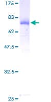 Human ARMC6 Protein (Recombinant GST)