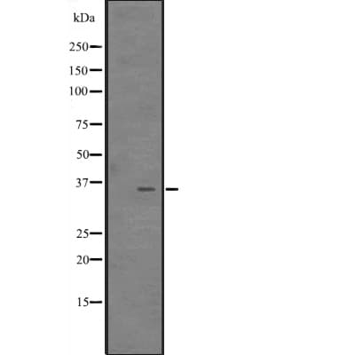 Polyclonal Rabbit anti-Human CITED4 Antibody (WB)