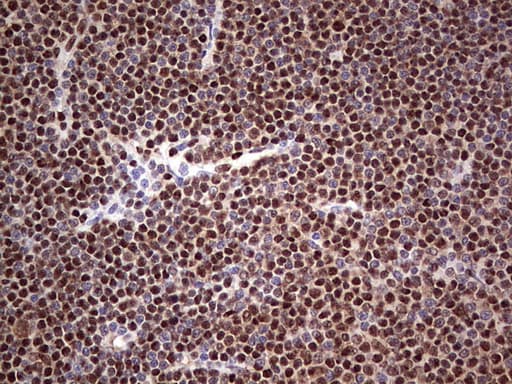Monoclonal Mouse anti-Human SAE1 Antibody (clone OTI6B11, Carrier-free, IHC, WB)
