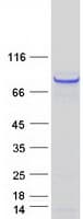 Human RAD18 Protein (Recombinant Myc-DDK (Flag))