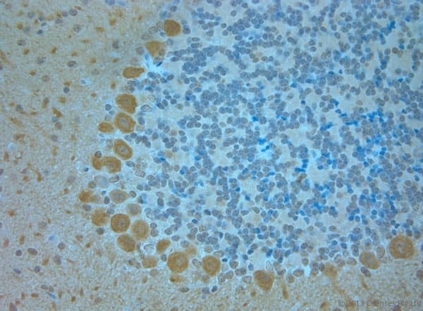 Polyclonal Rabbit anti-Mouse TMEM37 Antibody (aa160-211, IHC)