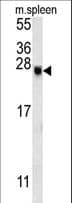 EID2 Antibody (aa177-208)