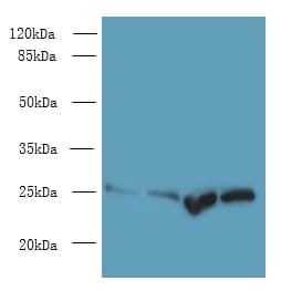 Polyclonal Rabbit anti-Rat SOCS3 Antibody (WB)