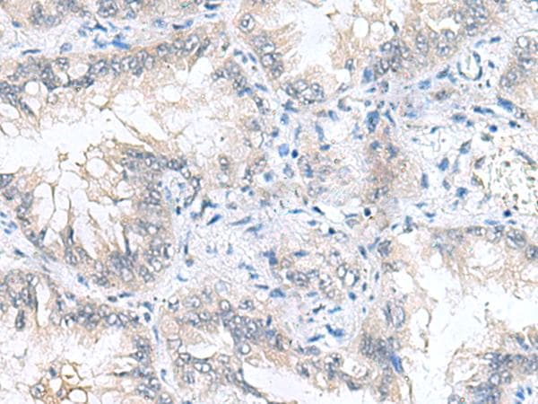 CAMSAP3 / KIAA1543 Antibody