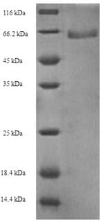 Gardnerella vaginalis Modification Methylase AccI Protein (Recombinant 6His, N-terminus)