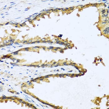GNRH Antibody