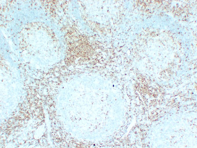 CD5 Antibody (clone ABT-CD5)
