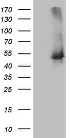 Monoclonal Mouse anti-Human TWF1 / PTK9 Antibody (clone OTI5C11, Carrier-free, aa140-384, WB)