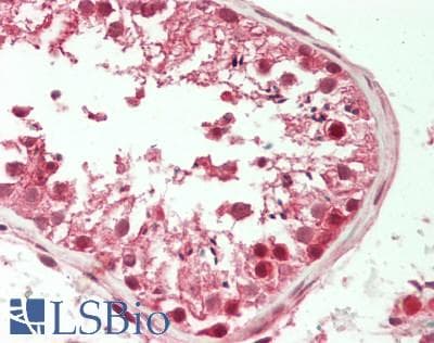 IHC-plus™ AQR Antibody (aa500-550)