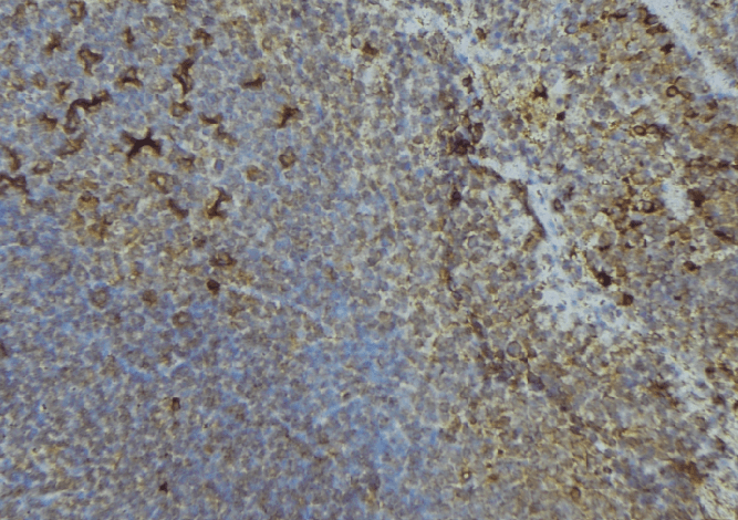 ISG15 Antibody