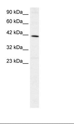 FOXF2 Antibody (aa52-101)