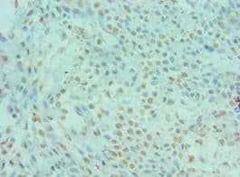 DYRK2 Antibody (aa502-601)