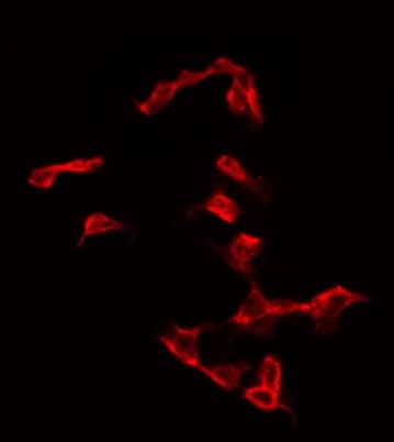 GYS1 / Glycogen Synthase Antibody (phospho-Ser645)