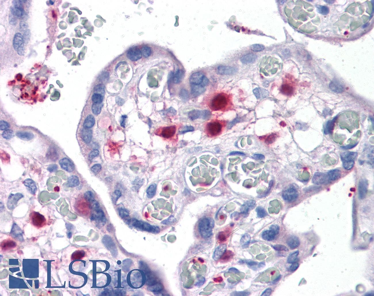 IHC-plus™ PLEK / Pleckstrin Antibody (clone 6E3)