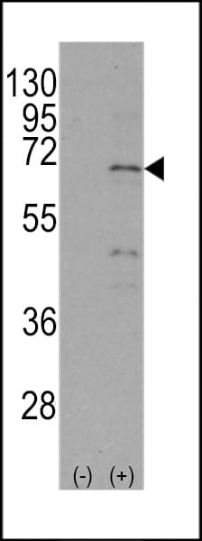 NR4A1 / NUR77 Antibody (Ser351)