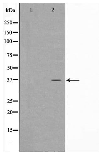 Polyclonal Rabbit anti-Human CARP / ANKRD1 Antibody (WB)