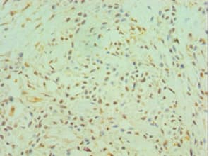 Polyclonal Rabbit anti-Human CTSK / Cathepsin K Antibody (aa115-329, IHC, WB)