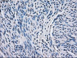BCKDK Antibody (clone OTI11C9)