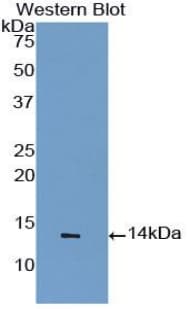 SNCA / Alpha-Synuclein Antibody (aa23-140)