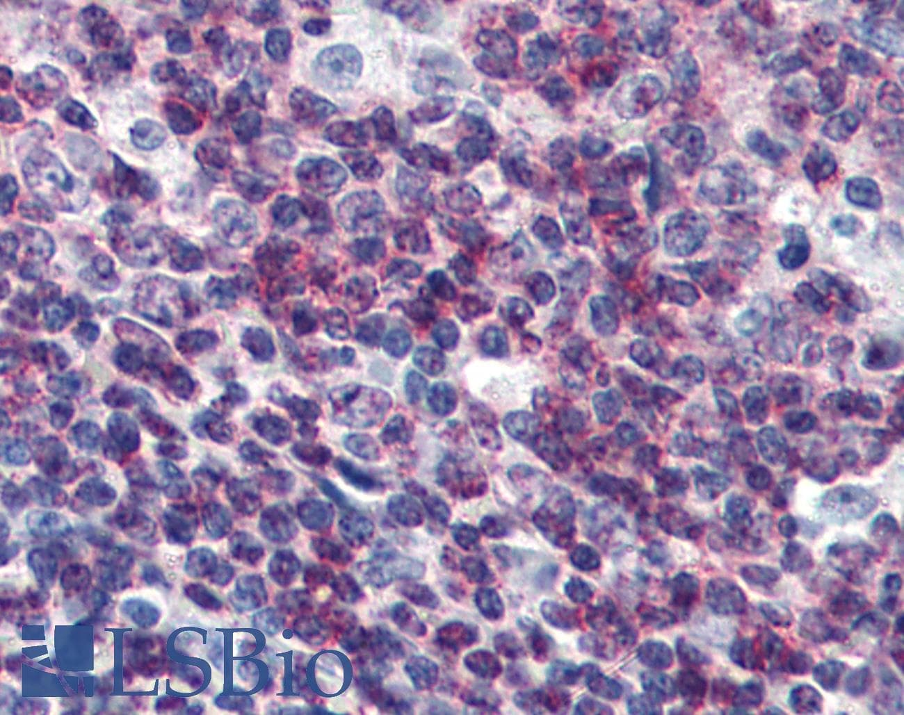 IHC-plus™ Monoclonal Mouse anti-Human C/EBP Beta / CEBPB Antibody (clone 47A1, IHC, IF, WB)