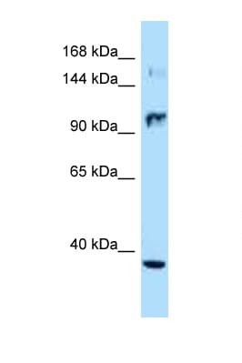 NOS2 / iNOS Antibody (aa32-81)