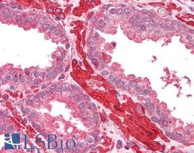 IHC-plus™ TPM4 Antibody (aa266-276)