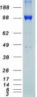 Human ROR1 Protein (Recombinant Myc-DDK (Flag))