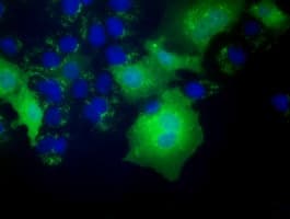 SLIM / FHL1 Antibody (clone OTI3H3)