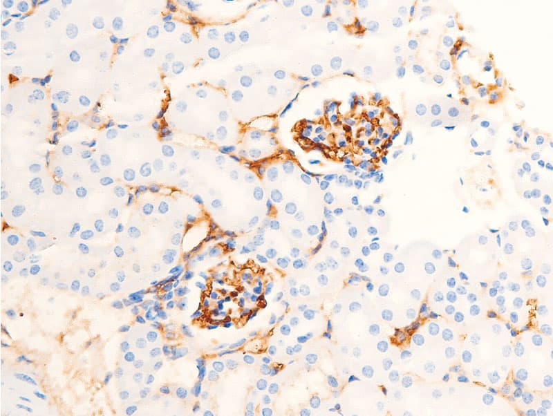 CHEK1 / CHK1 Antibody (phospho-Ser286)
