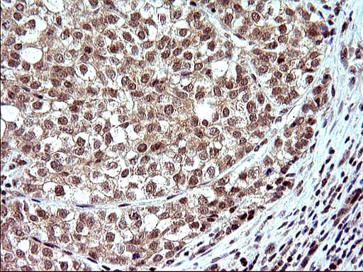 NDN / Necdin Antibody (clone OTI5D1)
