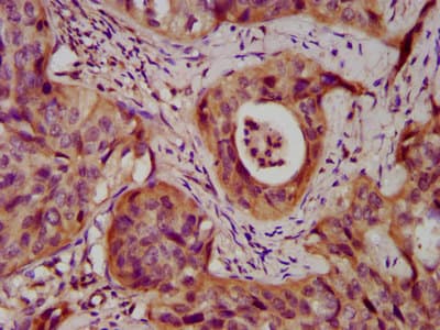 DSC3 / Desmocollin 3 Antibody
